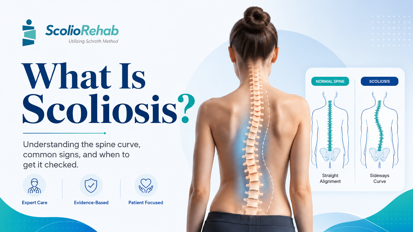 Scoliosis definition